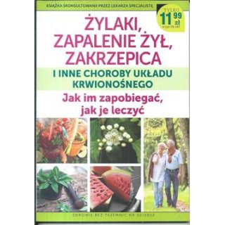 Żylaki, zapalenie żył, zakrzepica i inne choroby układu krwionośnego Zdrowie bez tajemnic 2/2022